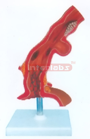 HUMAN RECTUM MODEL